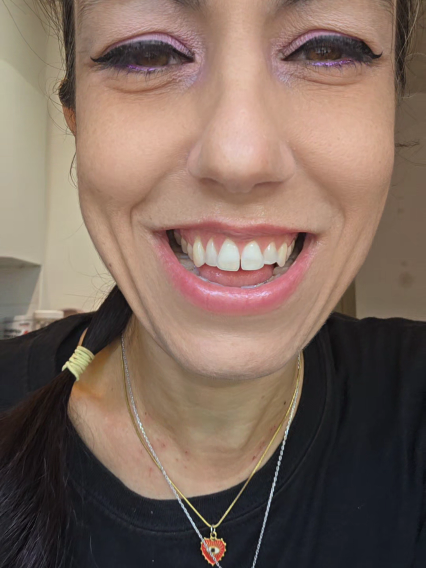 @Giom80