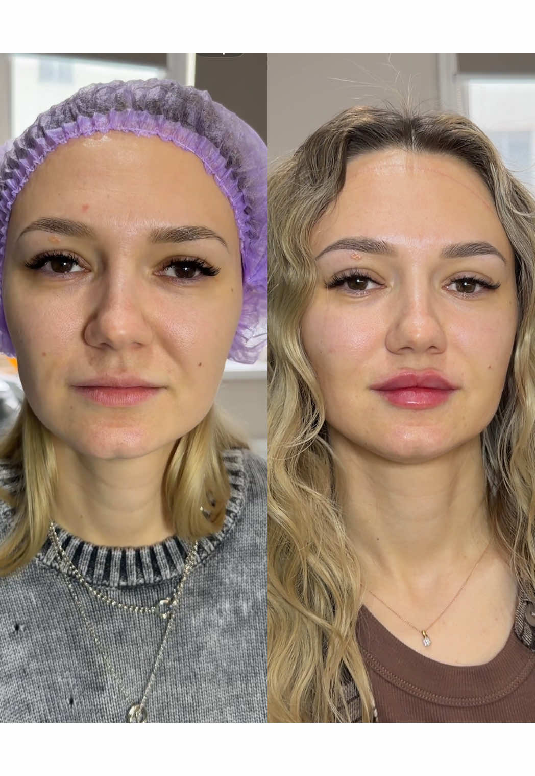 @Елена косметолог Волгоград