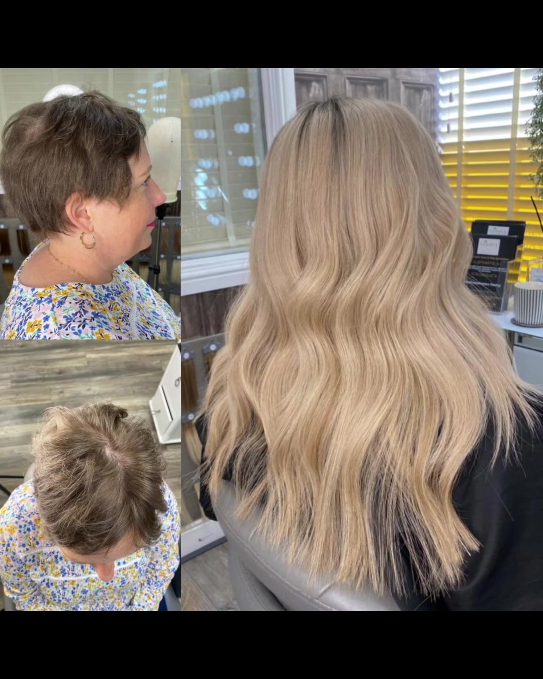 @Godiva Hair Loss Specialists