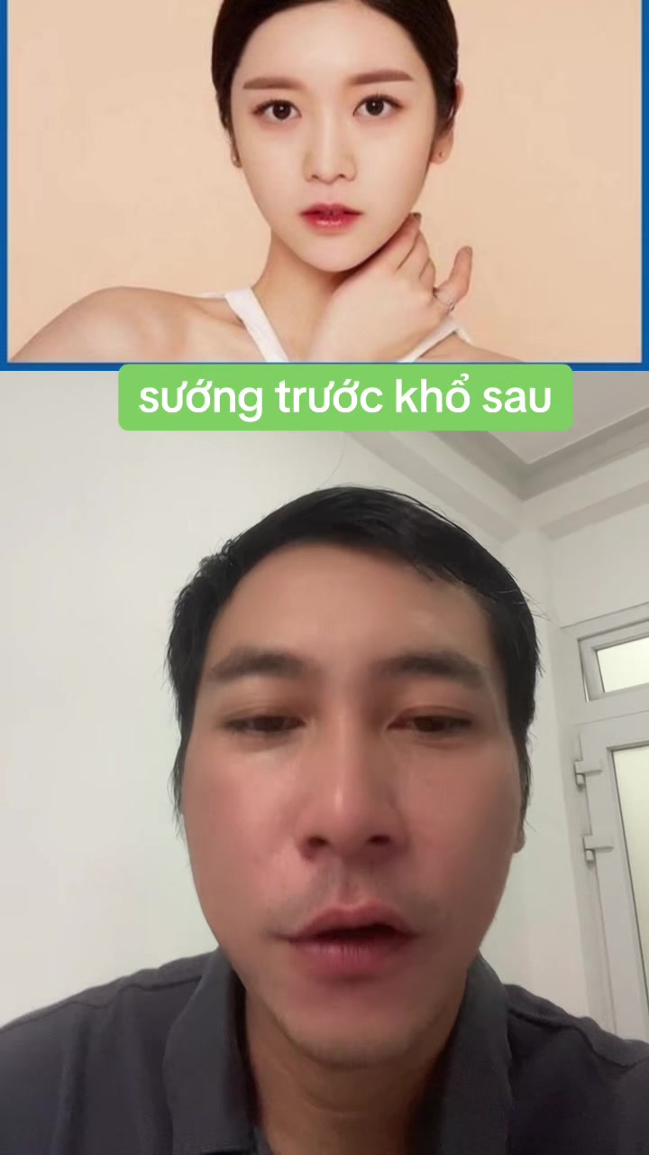 @Tuệ Nh&atilde;n ✅