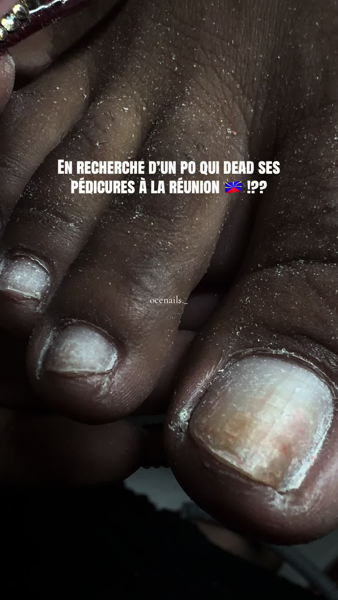 @ocenails