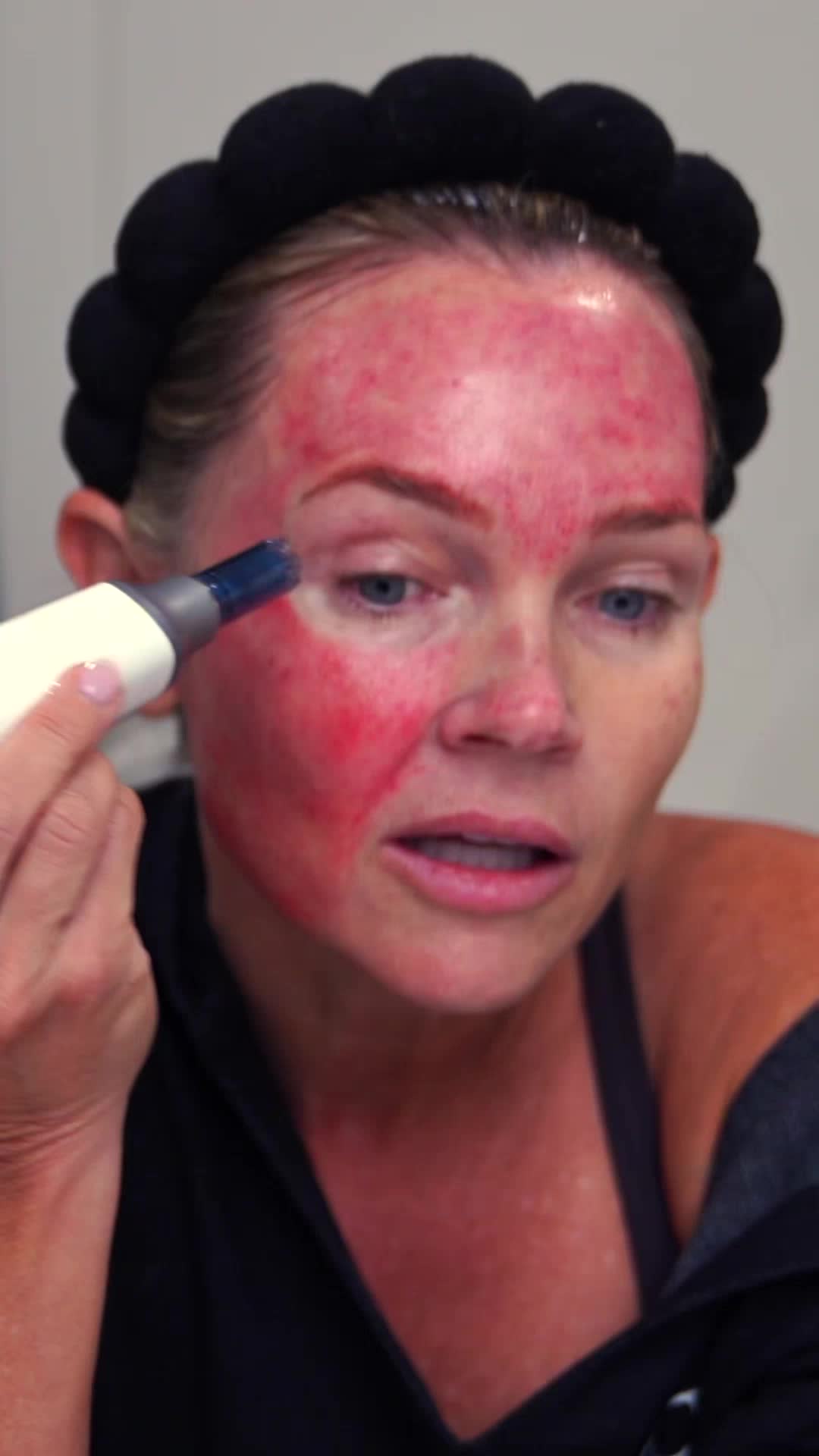 @DIY SKINCARE