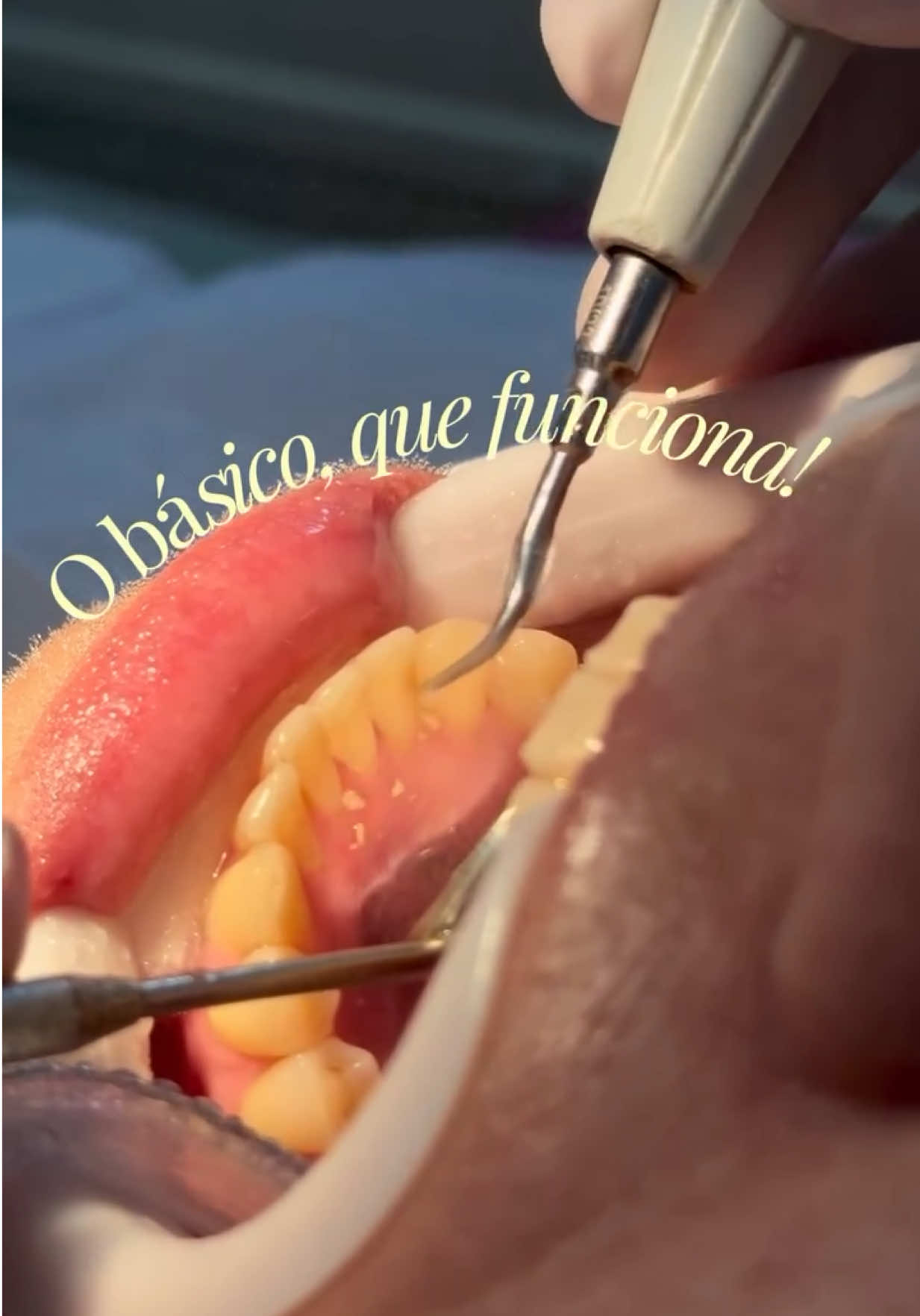 @Edinei Dias