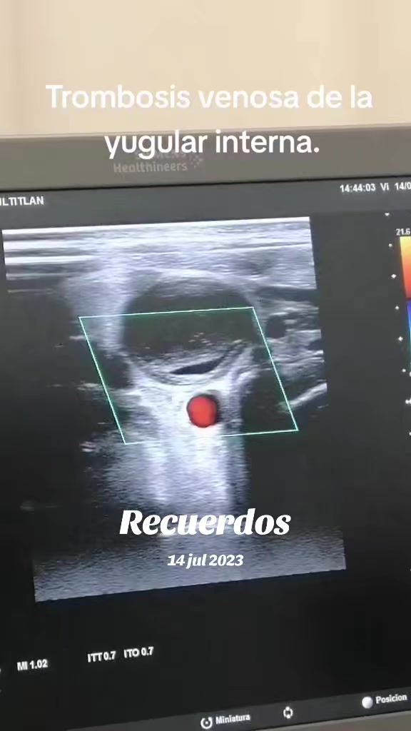 @Dr. Ajolote.