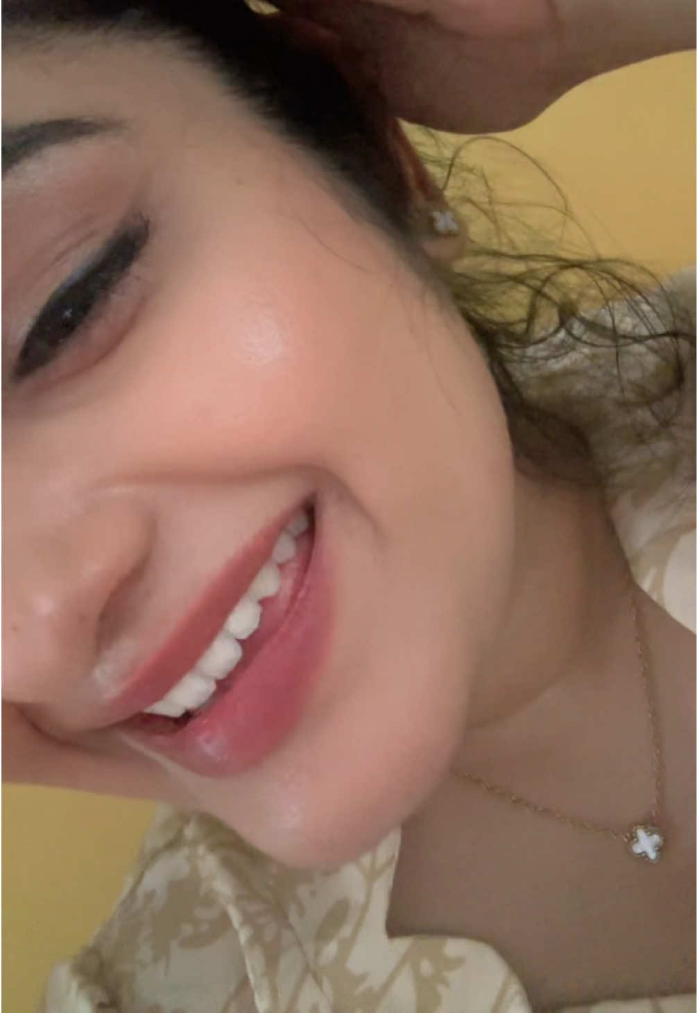 @Chithmini_Madawala🦄
