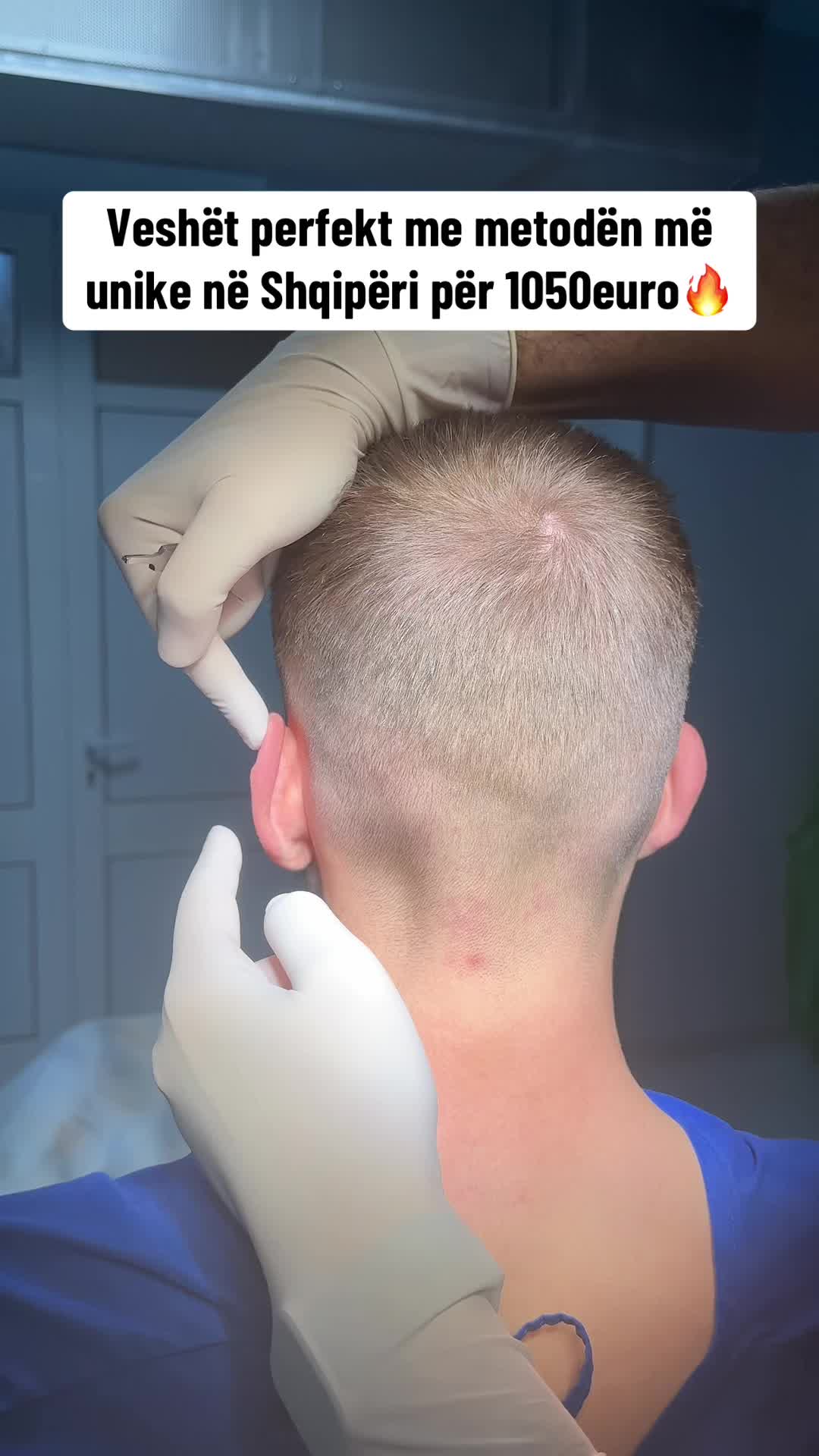 @rinoplasticatirana
