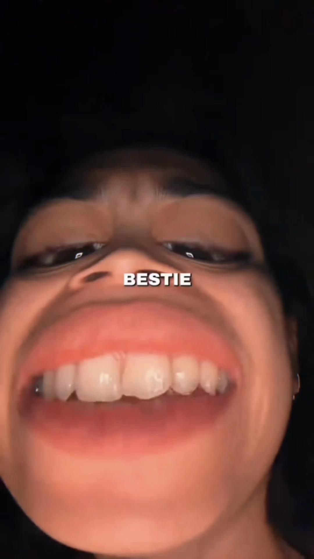 @Cilokkk🤩