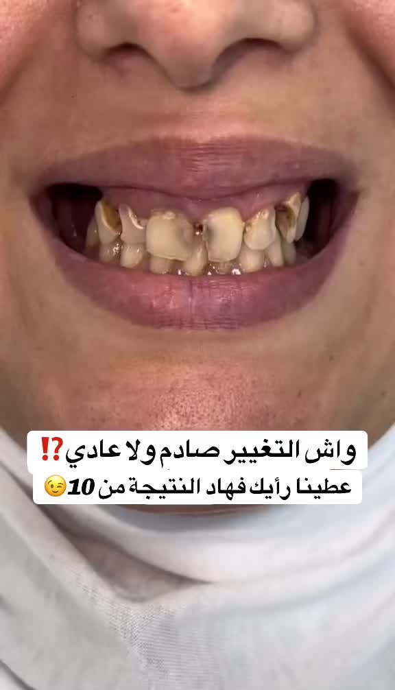 @brightsmileee1