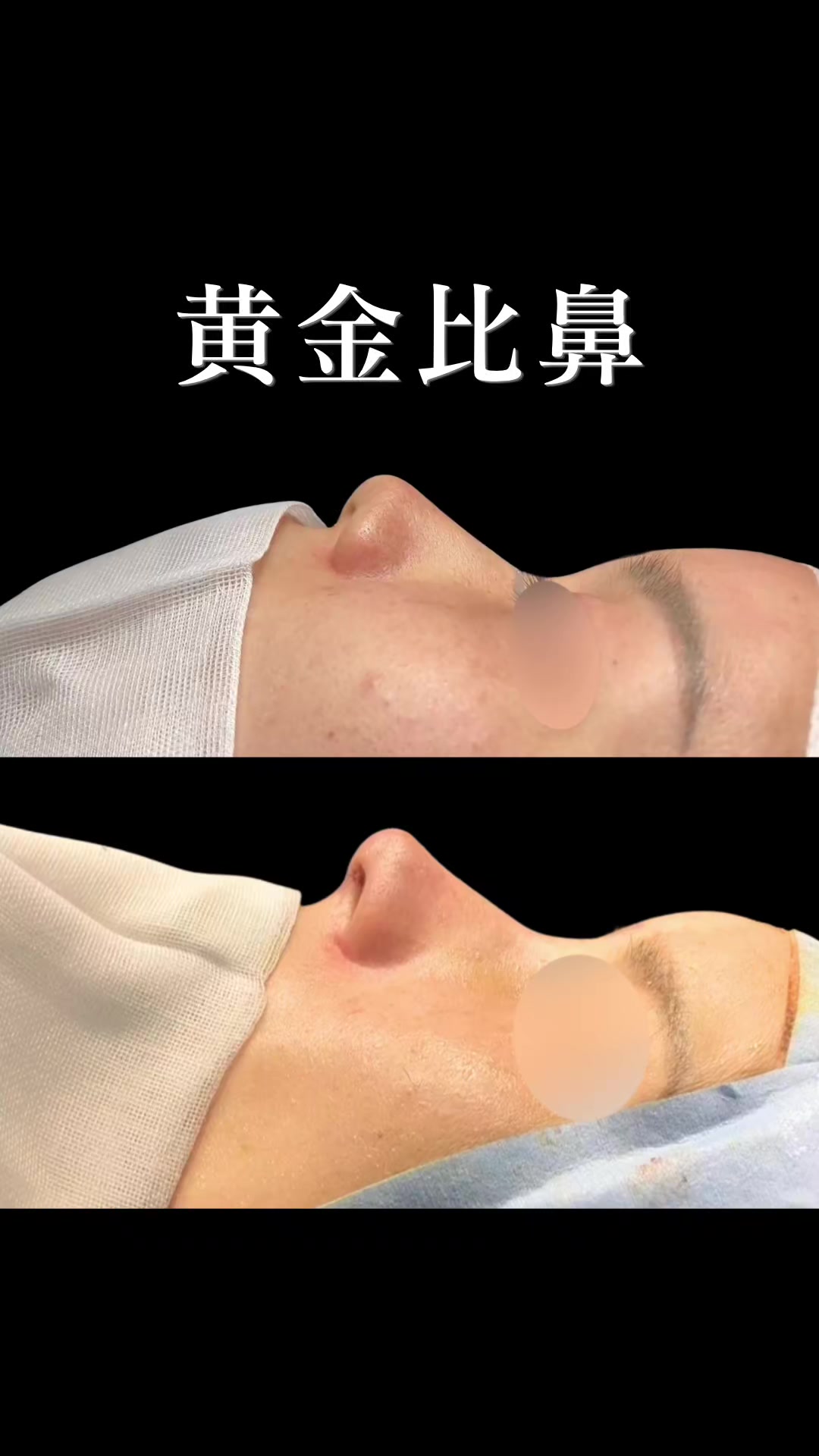@ソ院長(バウム美容外科/トータル整形)