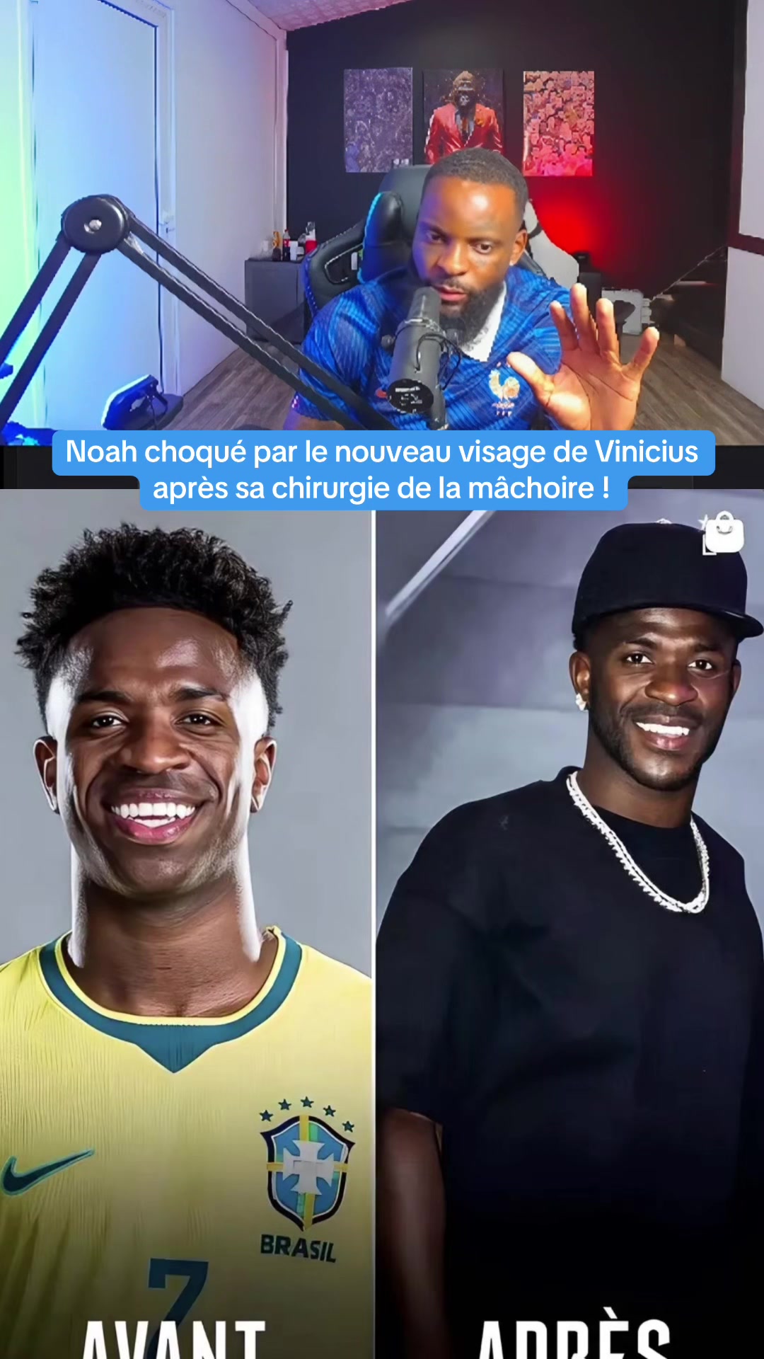 @VisionPlus
