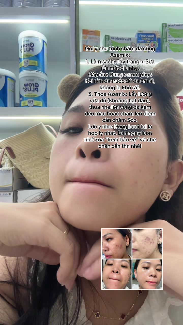 @Hoa Acne Skincare🌷