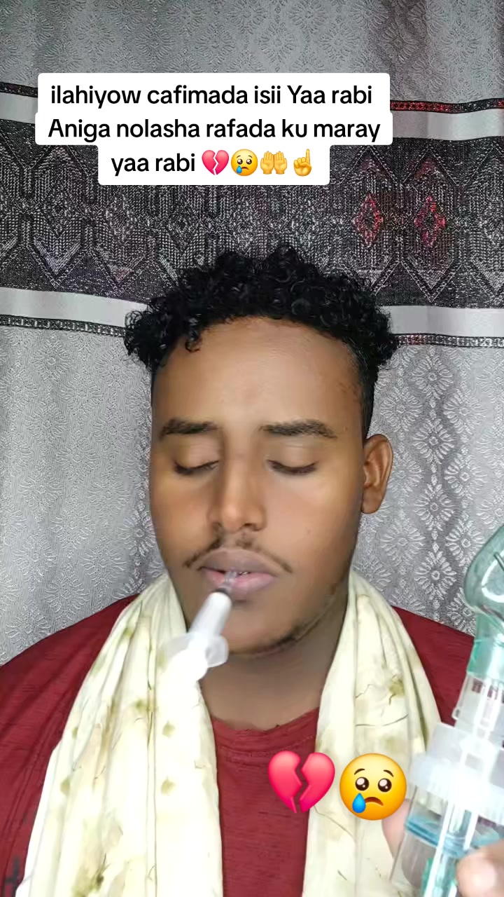 @Wiilka Xanuunka Lagu Nacay 😭