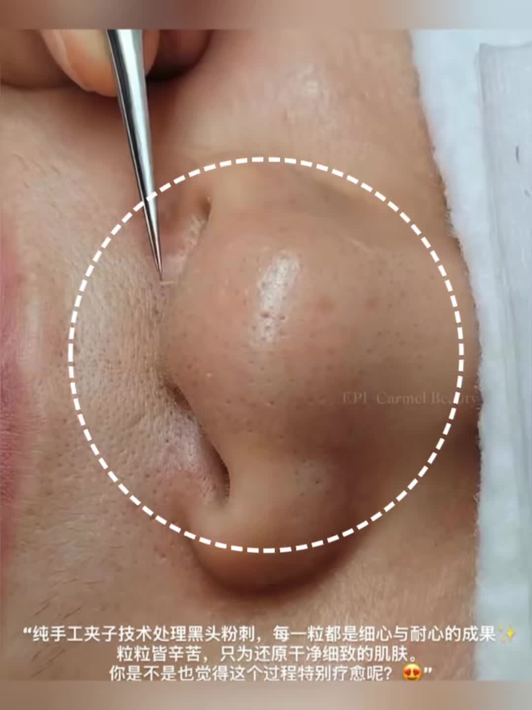 @Carmen皮肤问题杀手🥷
