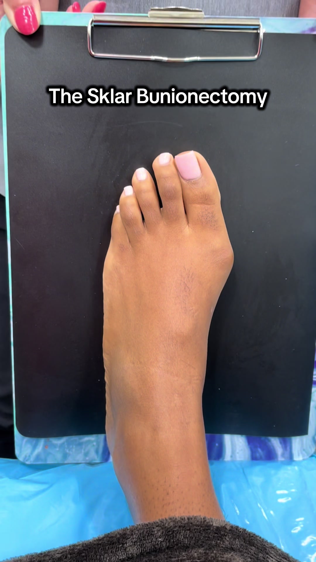 @Foot First Podiatry