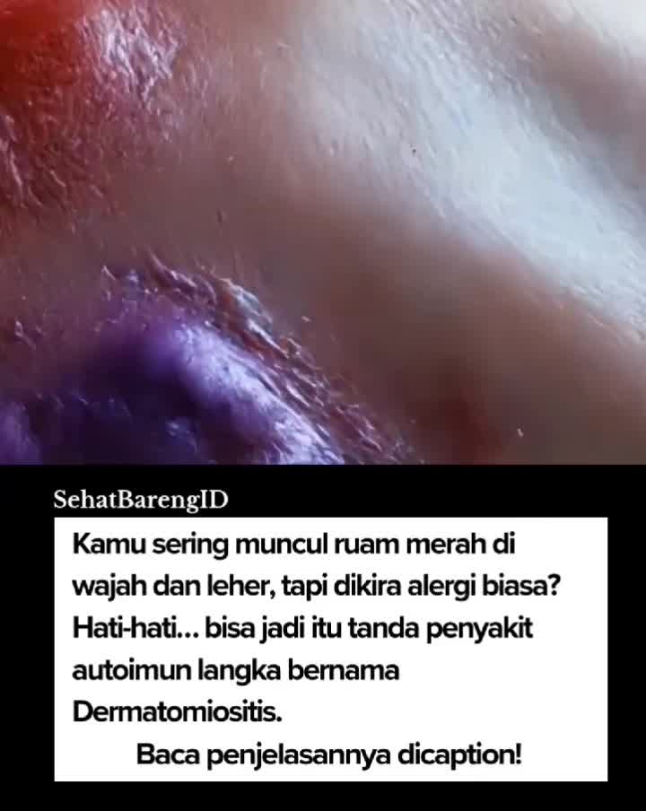 @SehatBarengID