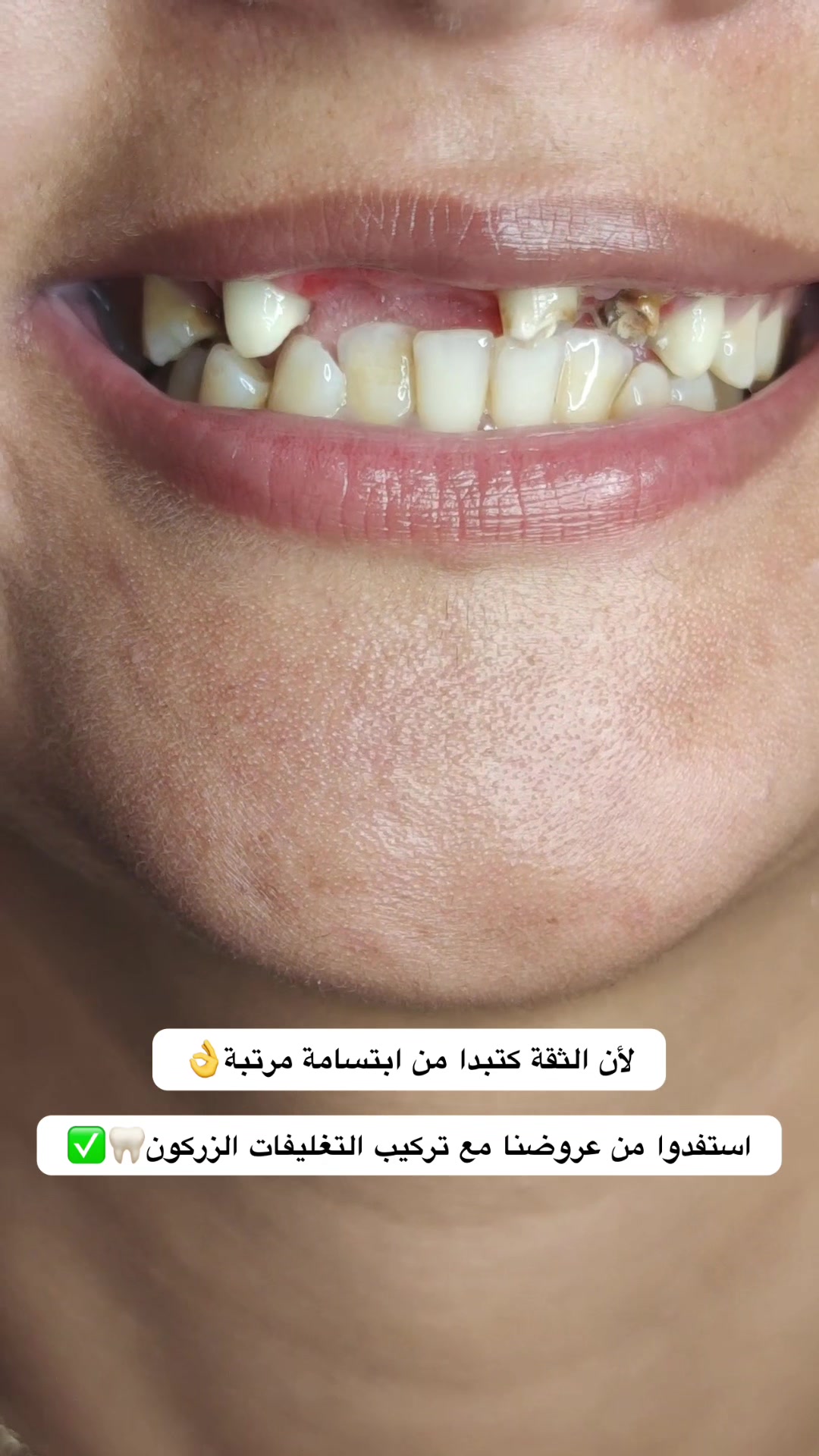 @brightsmileee1