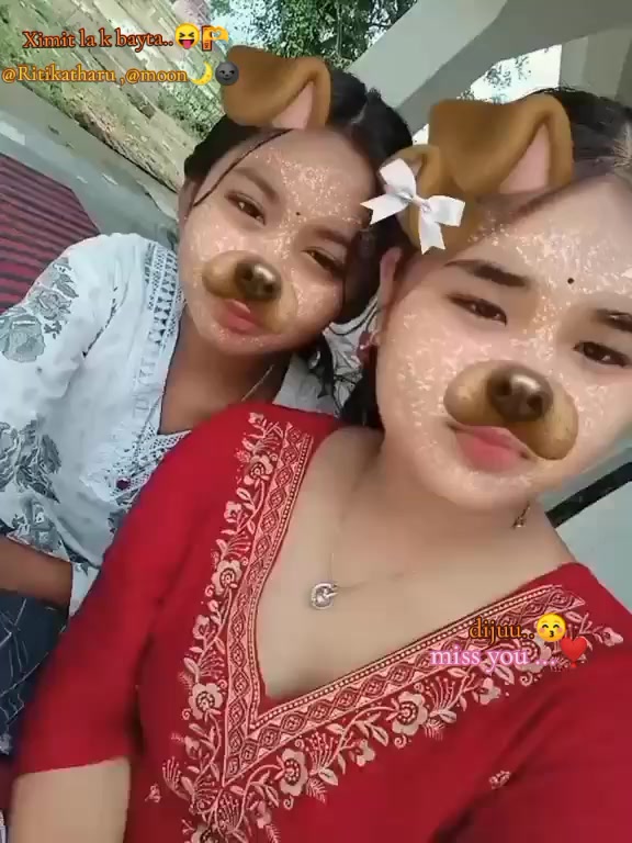 @Äyûü..❤️🩹😝