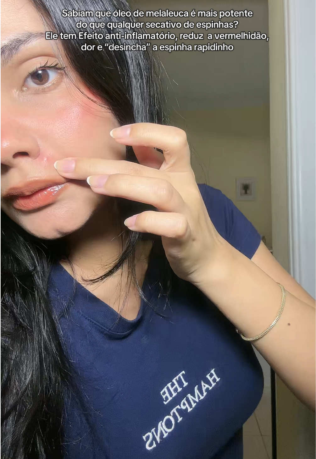 @Bianca