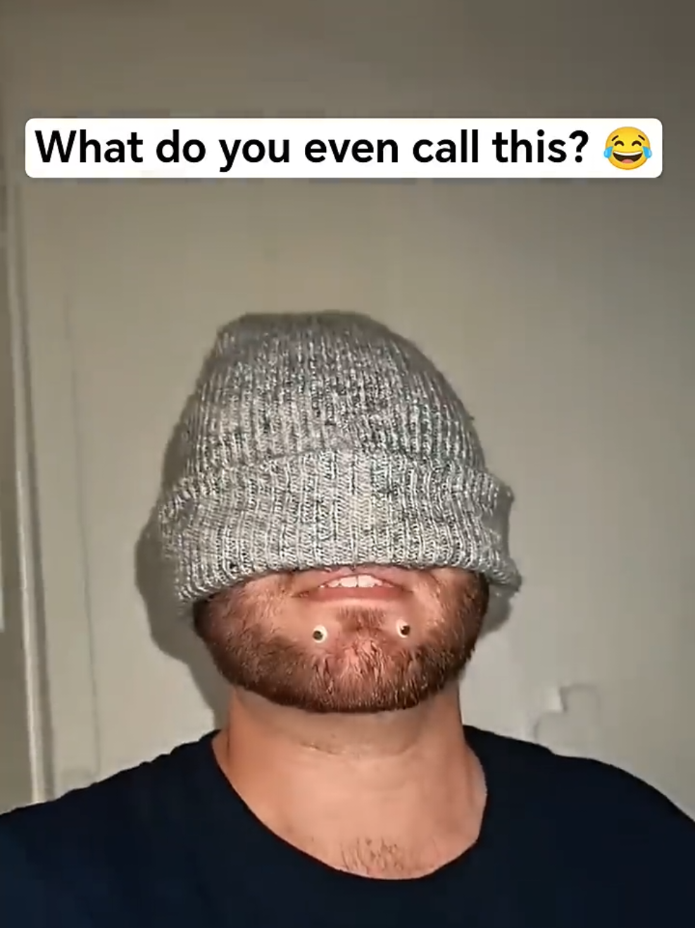 @Chinfaced