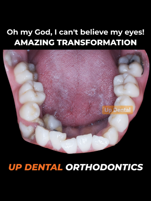 @Nha khoa niềng răng Up Dental