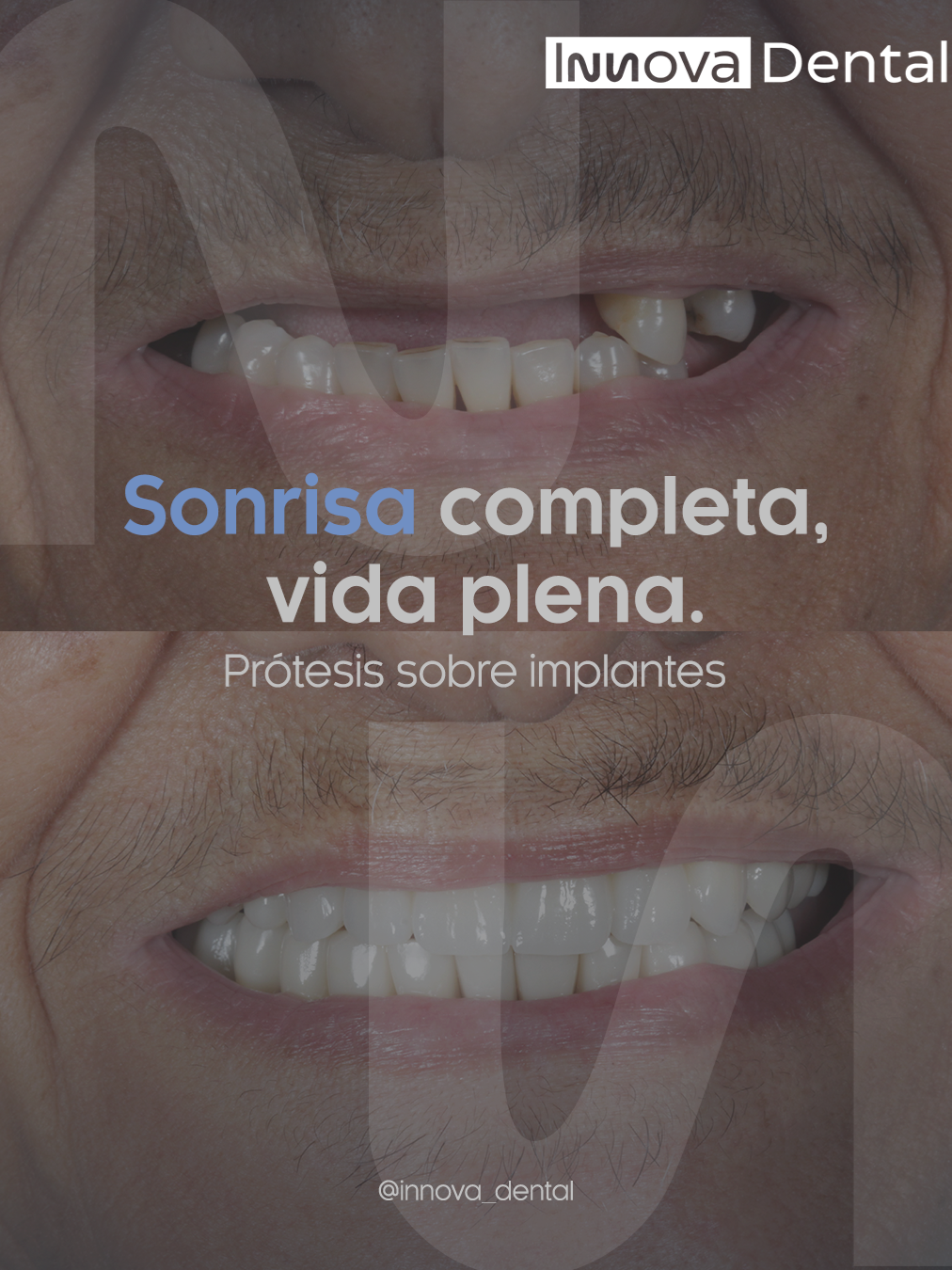 @Innova Dental Managua 🇳🇮