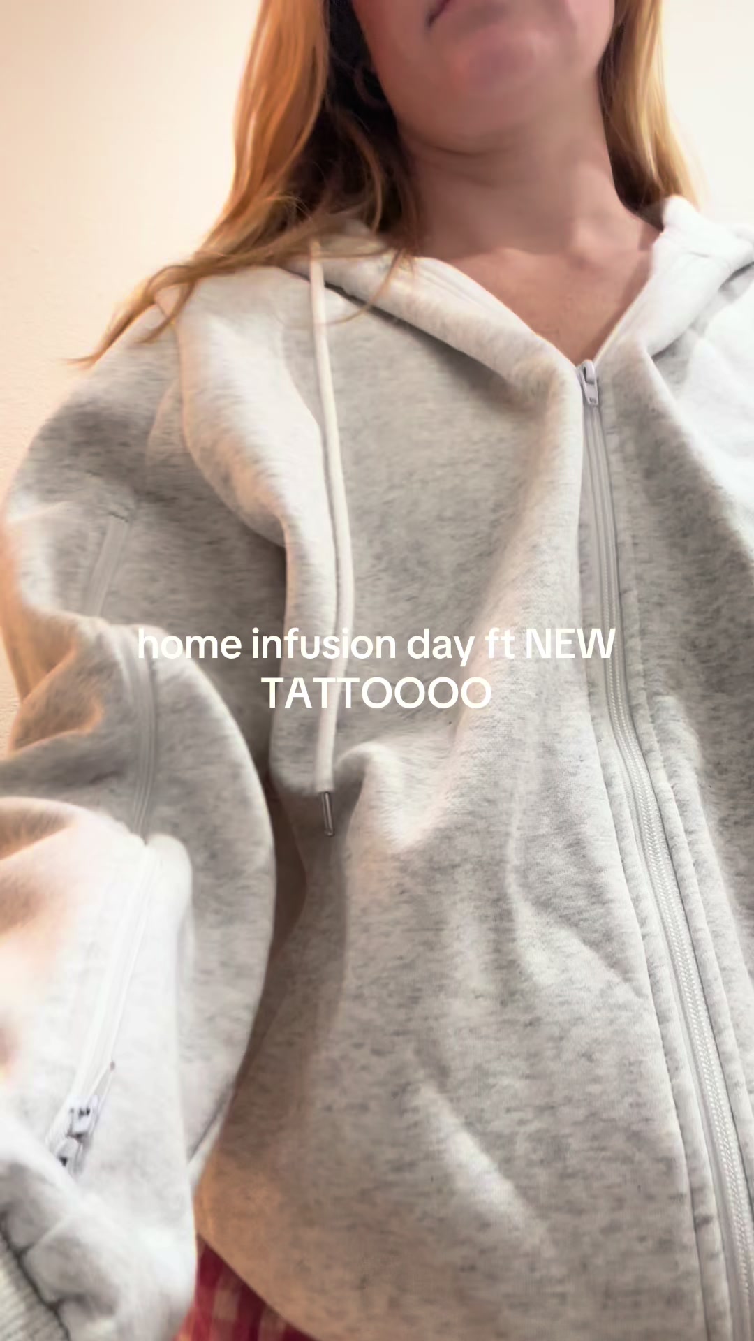 @hollyn🐞- OMS IV