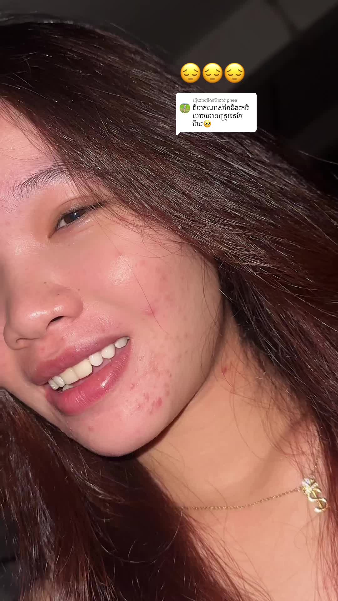 @កា៚តឿ