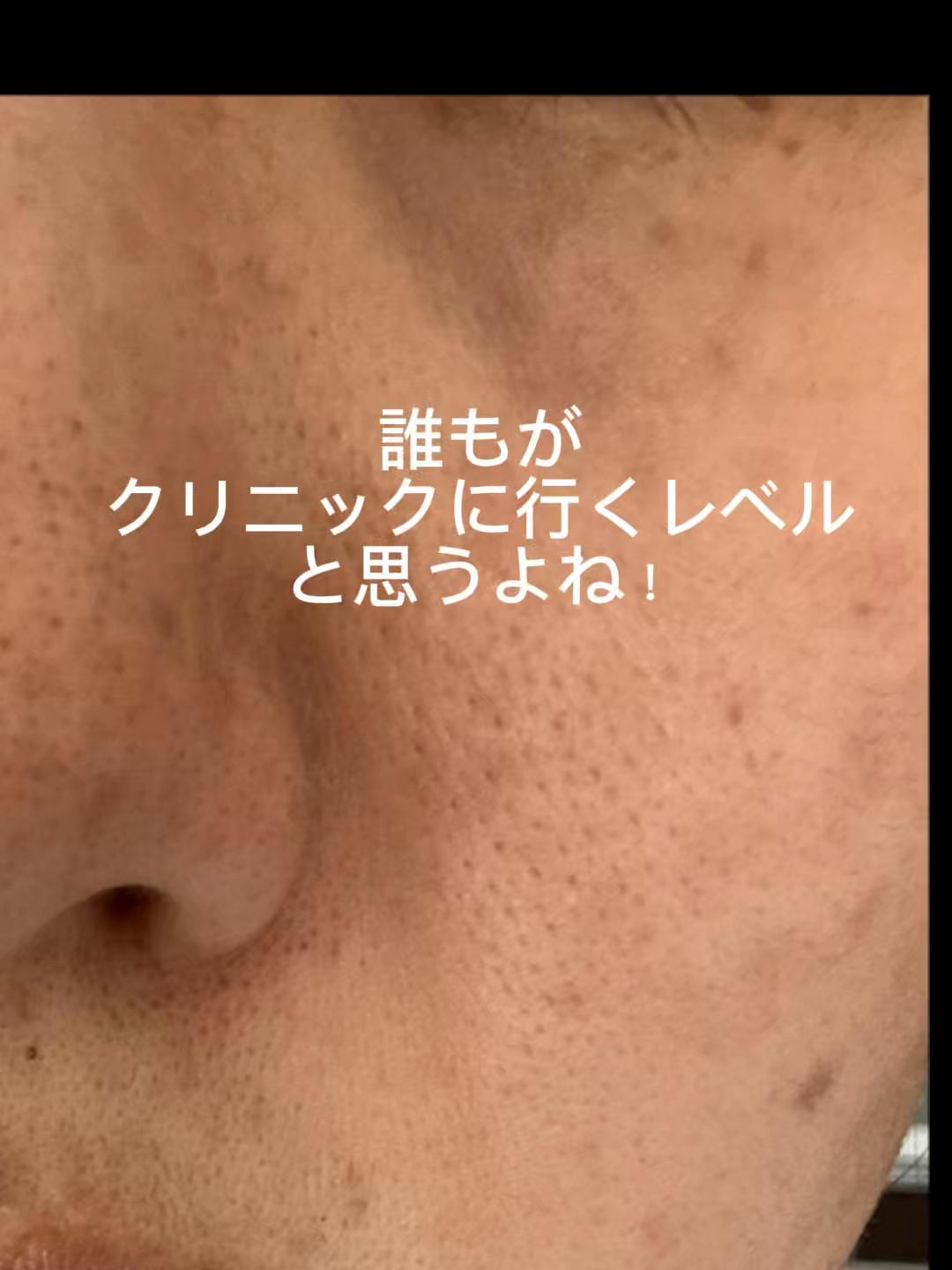 @HIROMI