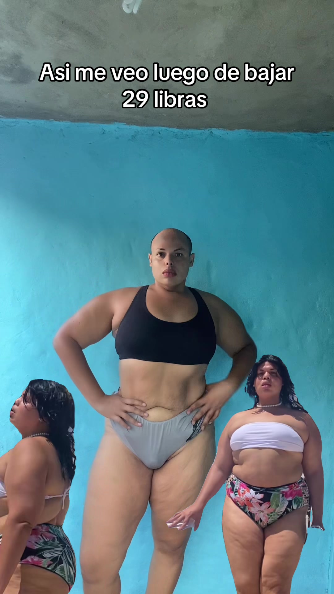 @Aby 🧑&zwj;🦲