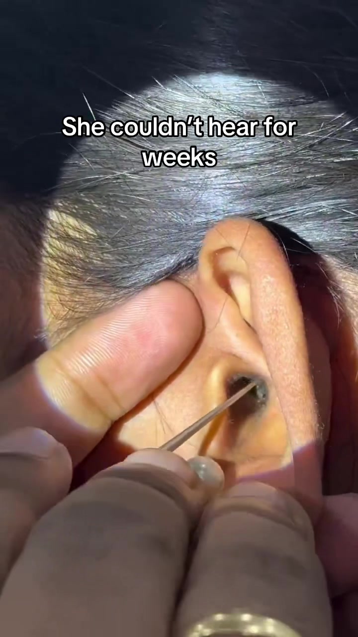 @Satisfying Ear Cleaning Videos