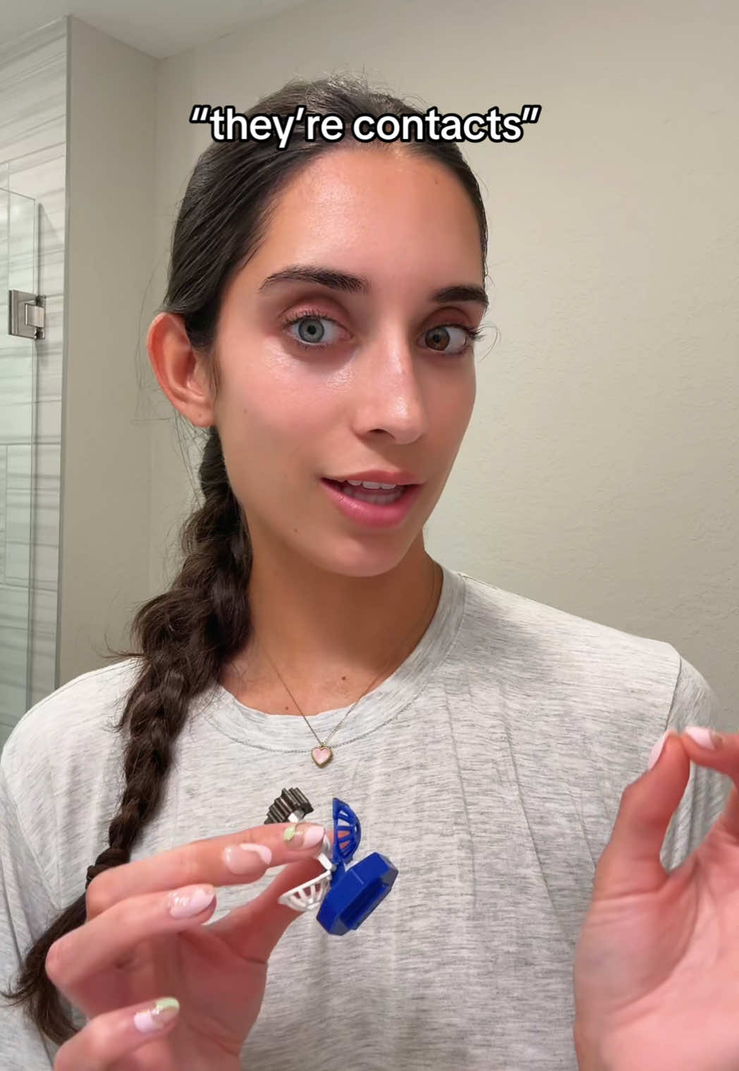 @Hope Baxter | heterochromia