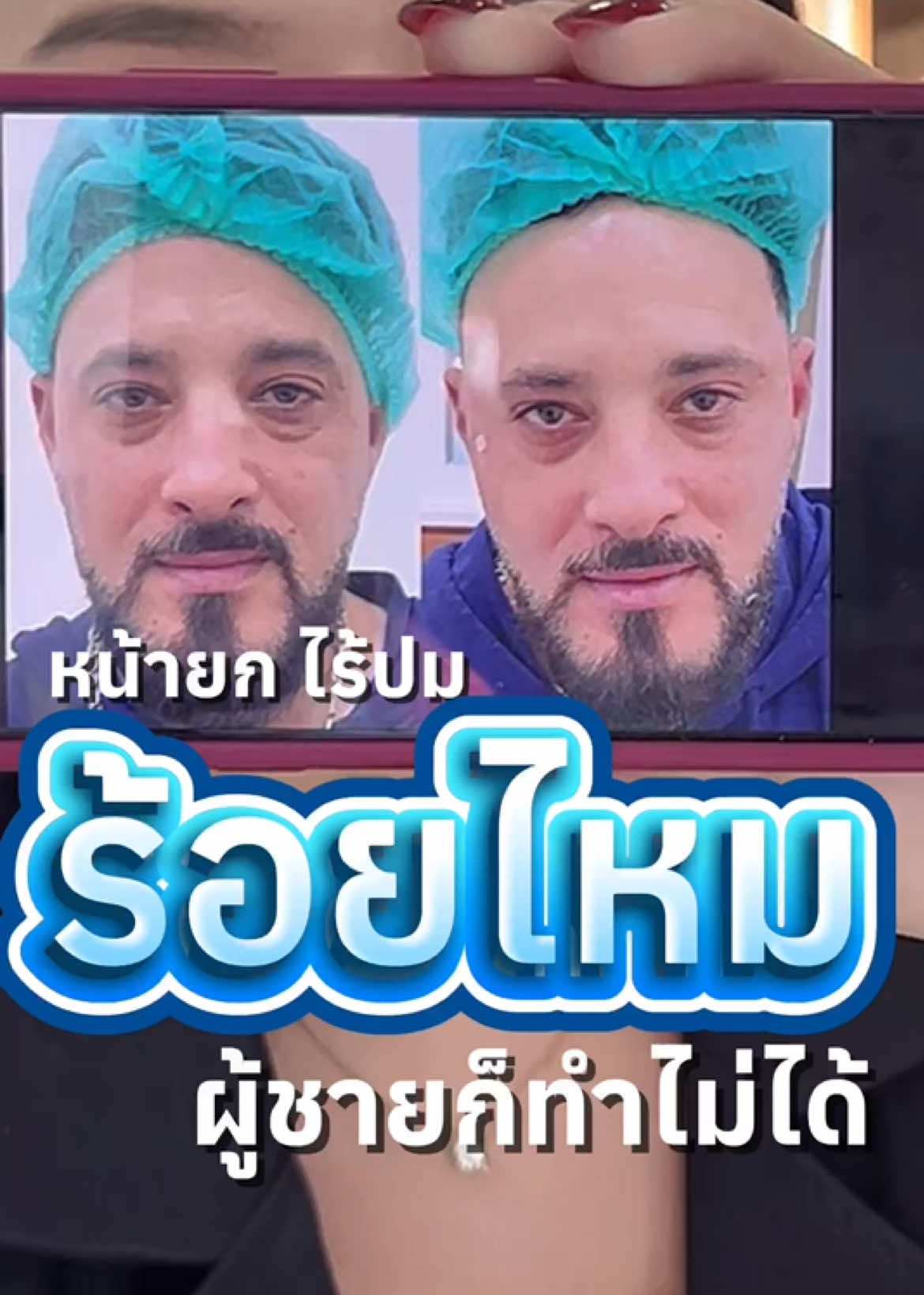 @กองจู พัทยา