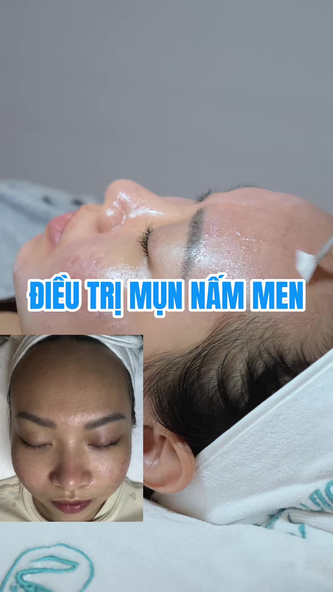 @Bác sĩ Trần Gia Khánh Da Liễu
