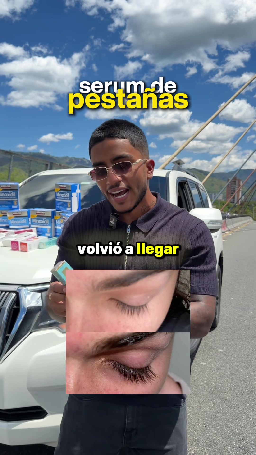 @cano.minoxidil
