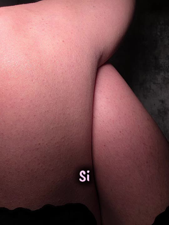 @Naphis