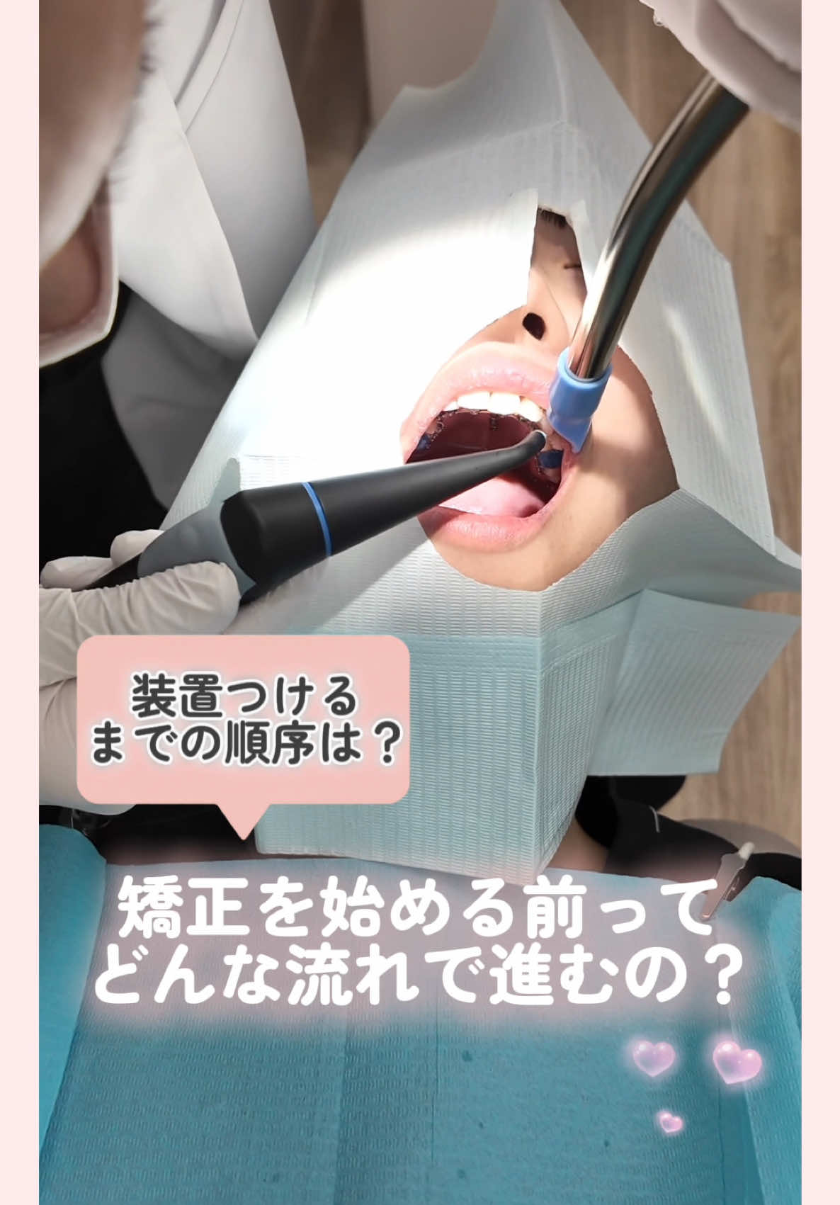@新宿南口矯正歯科