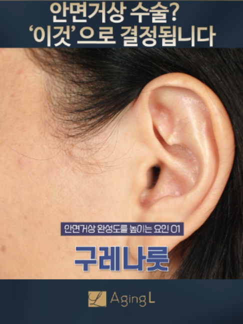 @agingl_official