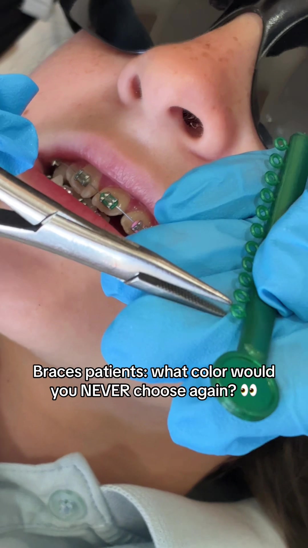 @Woodland Hills Orthodontist