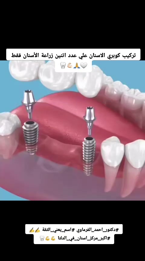 @دكتور احمد طلعت الفرماوي