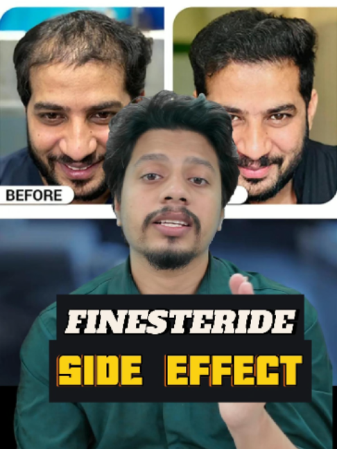 @NAZID HAIR TRANSPLANT