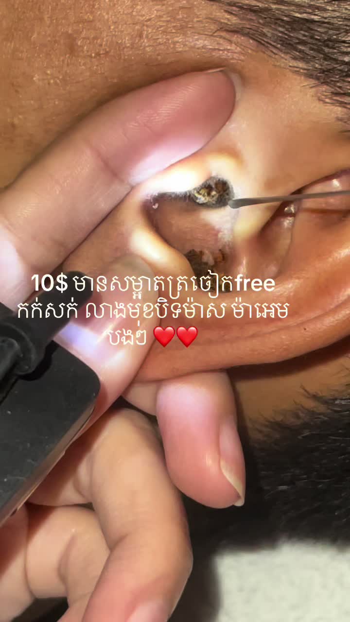 @ហាង សំអាតត្រចៀក 081 674455