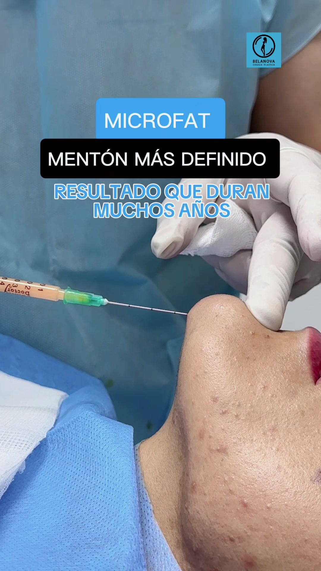 @Belanovacirugiaplastica