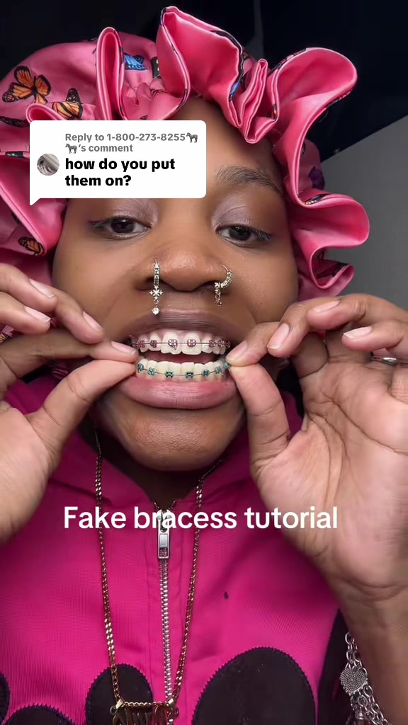 @Princessbracesplug🫶🏽🫆