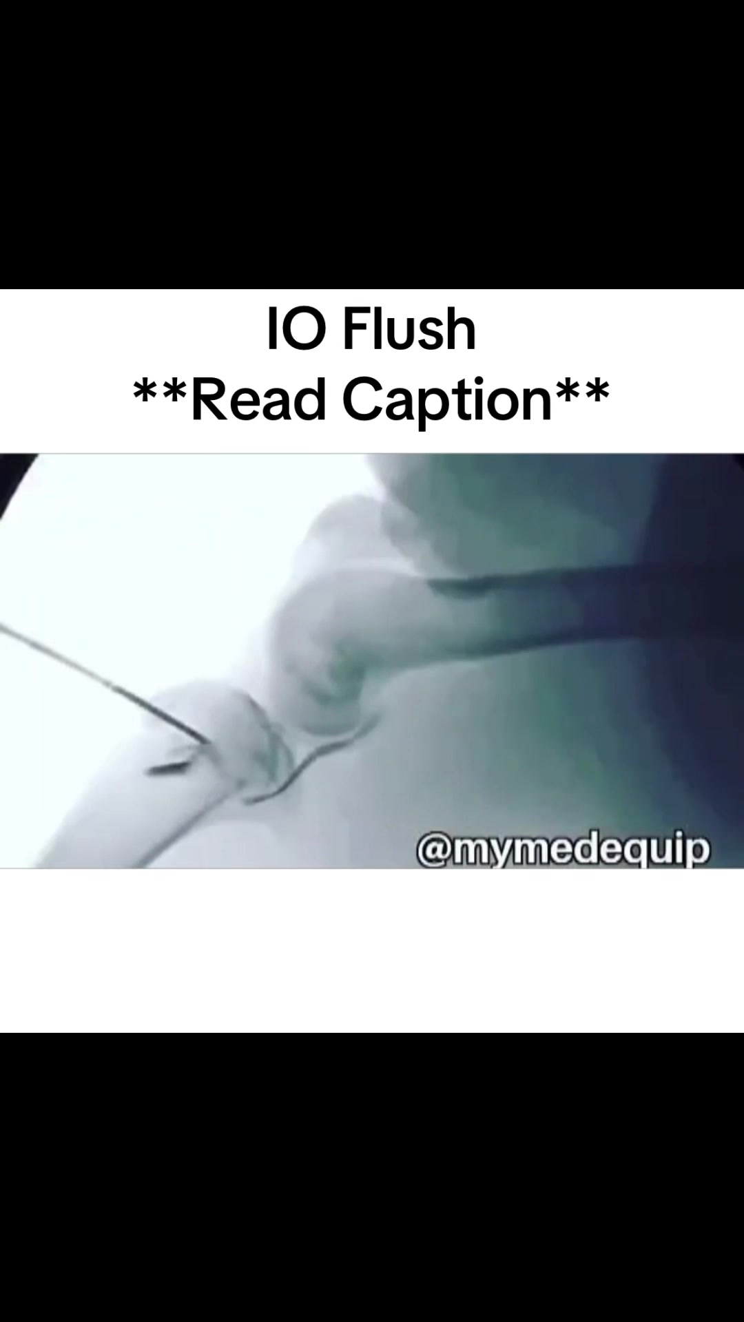 @TheIVGuy