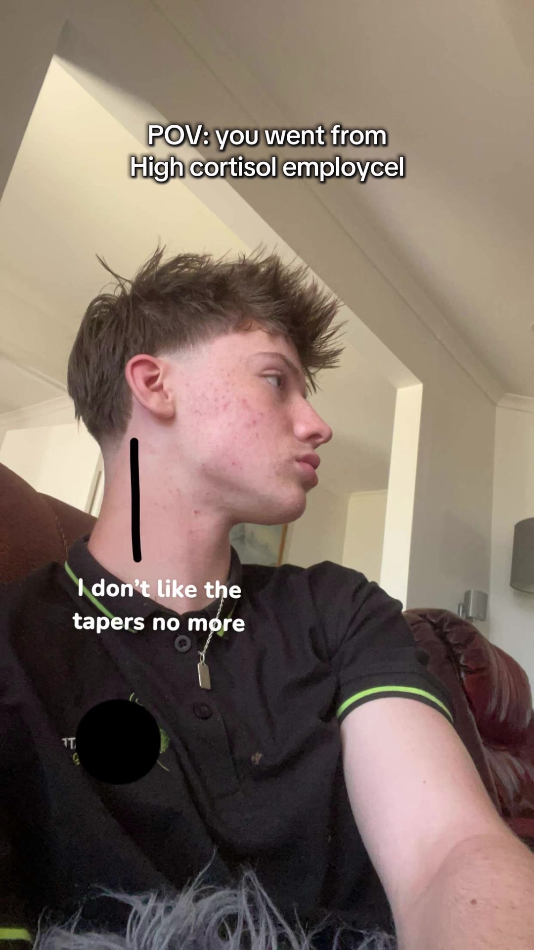 @Ant