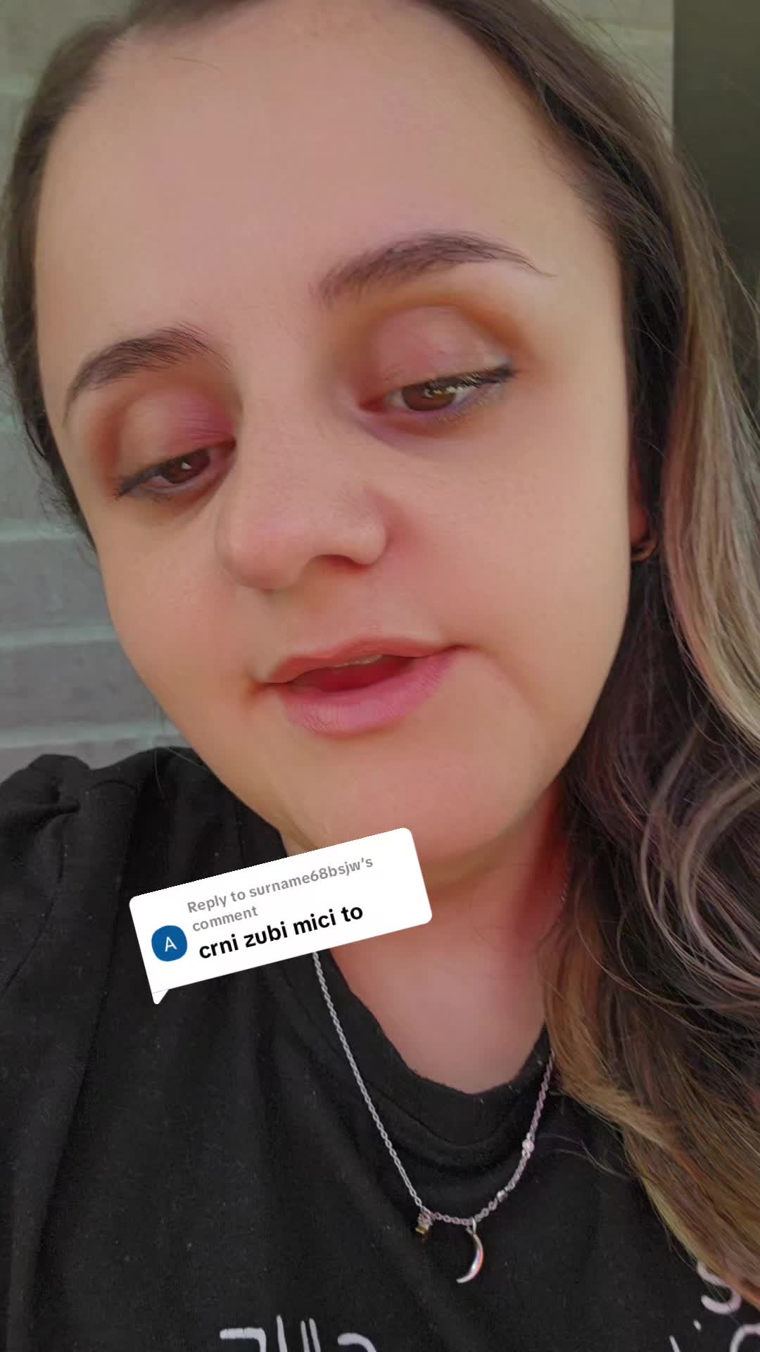 @Arbnora Elezi👩🦽