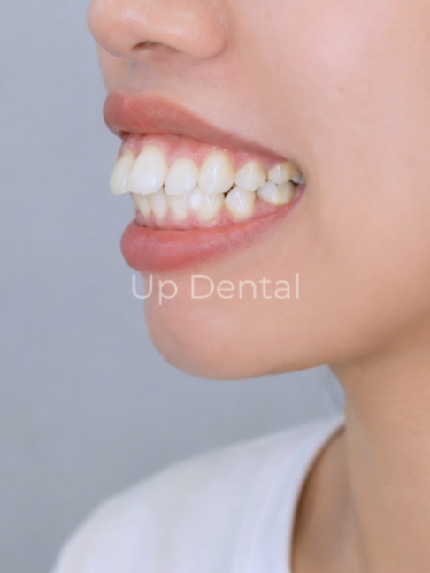 @Nha khoa niềng răng Up Dental