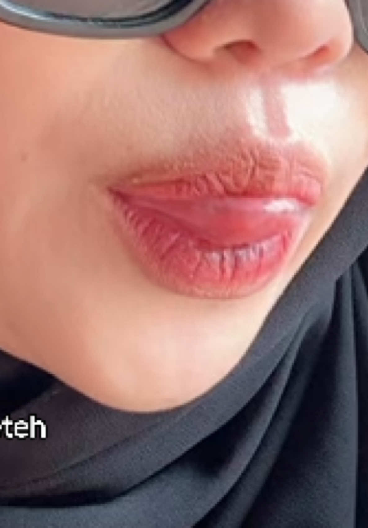 @Si teteh teteh