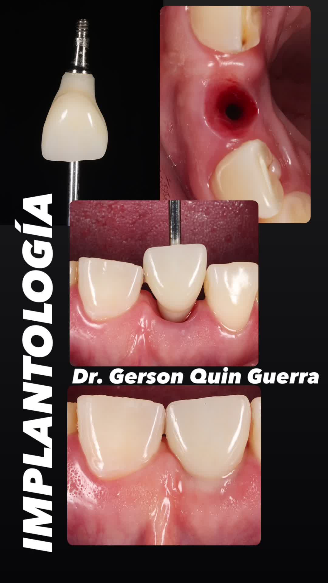 @Dr. Gerson Quin Guerra, PhD