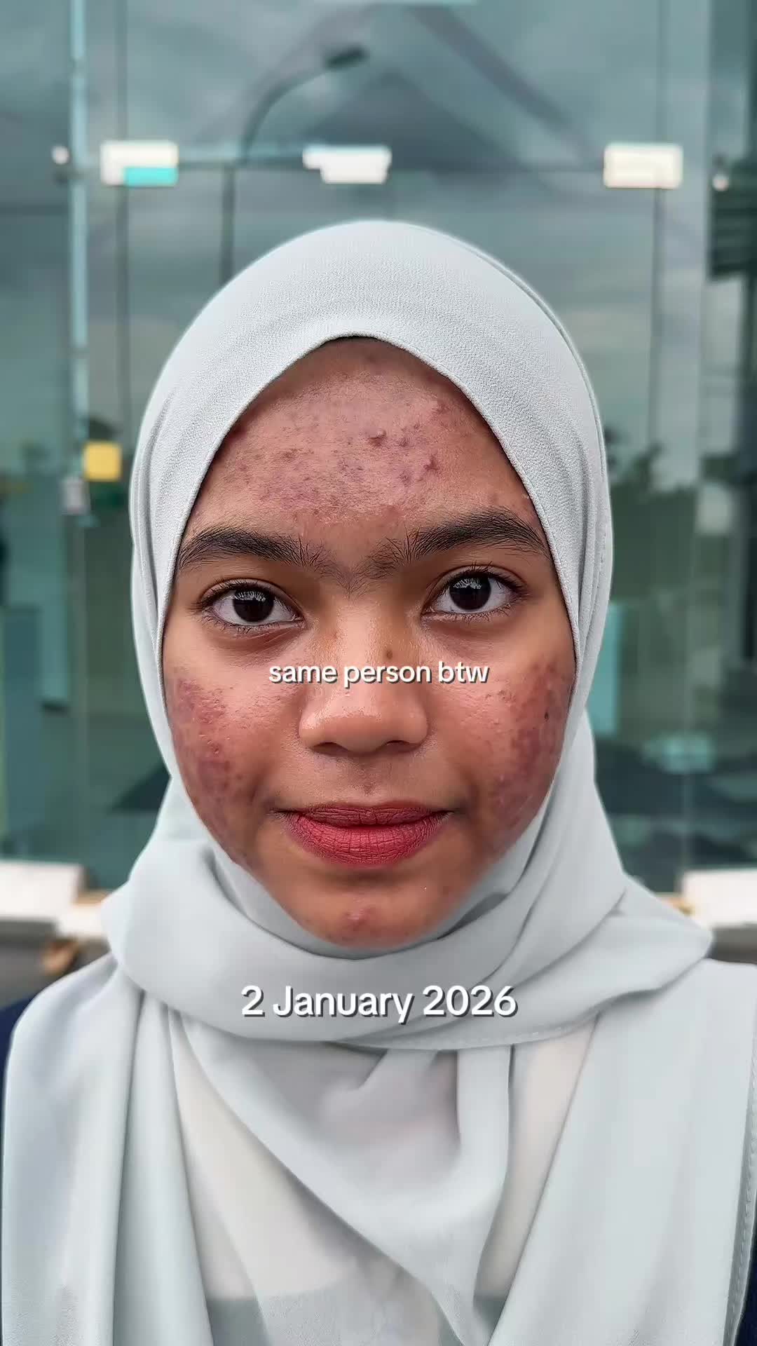 @AINAA